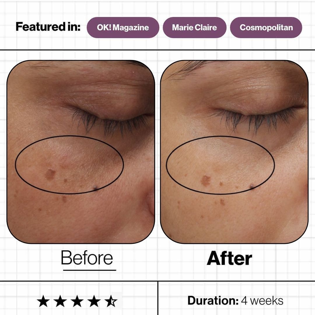 Skin Ultimate - Advanced Nutrition